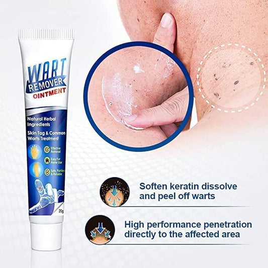 Wart Remover cream
