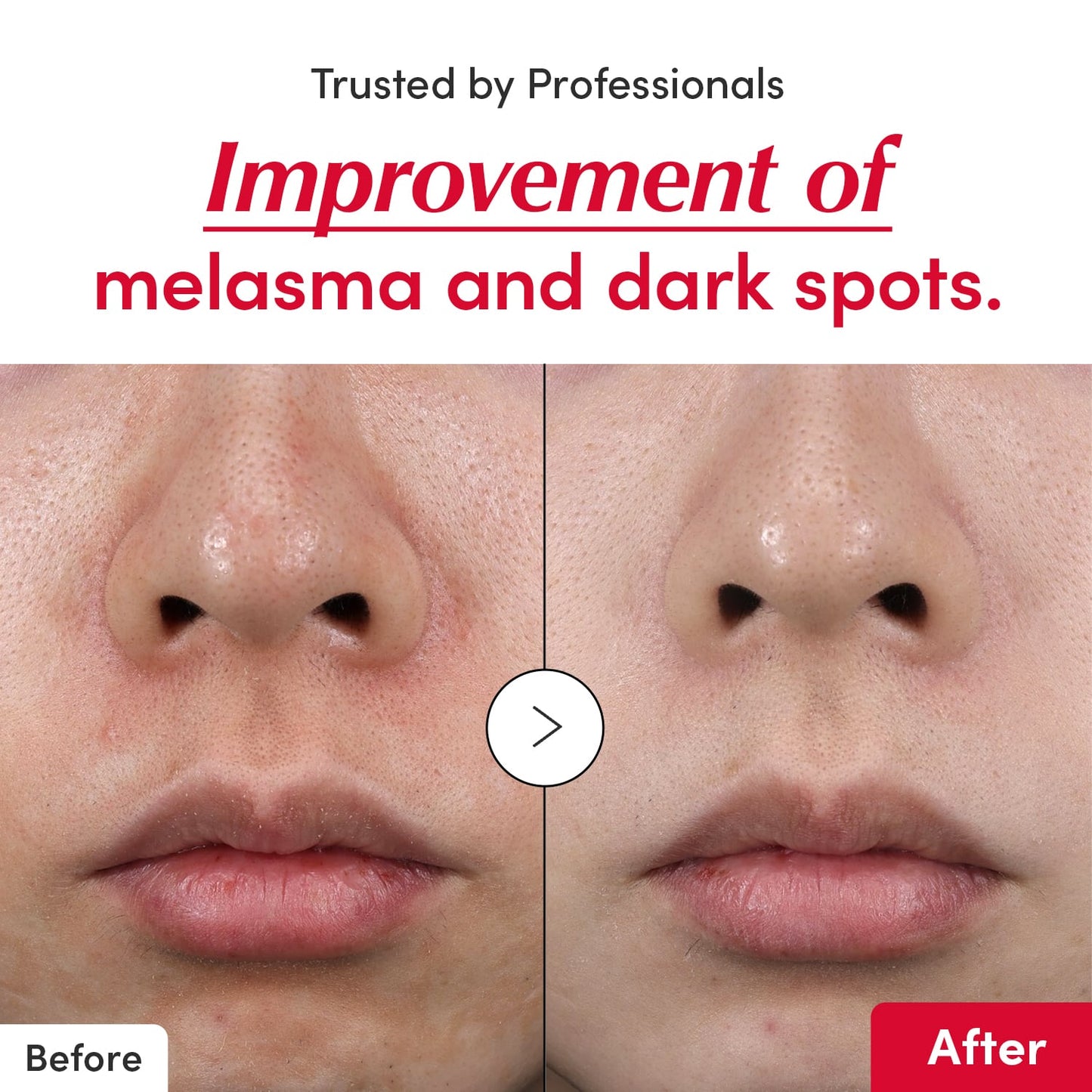 Eqqualberry Deep Cera Vitamin Illuminating Serum