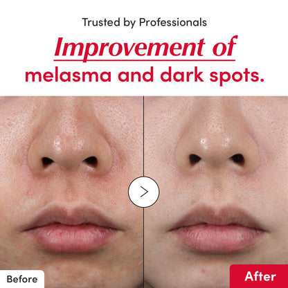 Eqqualberry Deep Cera Vitamin Illuminating Serum