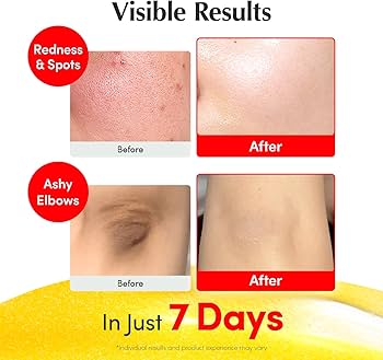 Eqqualberry Deep Cera Vitamin Illuminating Serum