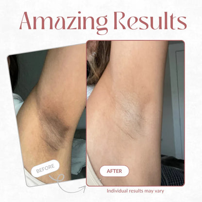 Dr.Melaxin Peel Shot Kojic acid and Turmeric Body Exfoliator