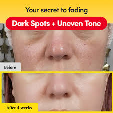 Eqqualberry Deep Cera Vitamin Illuminating Serum