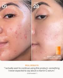 Eqqualberry Deep Cera Vitamin Illuminating Serum