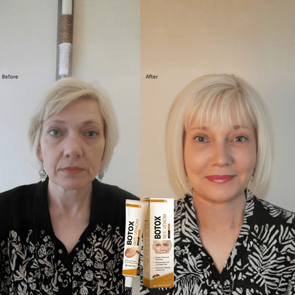 Bee Venom Botox Cream