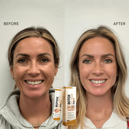 Bee Venom Botox Cream