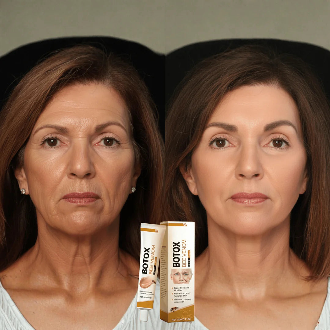 Bee Venom Botox Cream